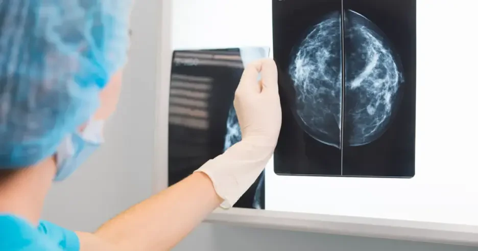 روشهای تشخیص سرطان پستان با ماموگرافی، سونوگرافی، MRI و بیوپسی