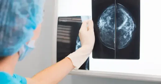 روش‌های تشخیص سرطان پستان با ماموگرافی، سونوگرافی، MRI و بیوپسی