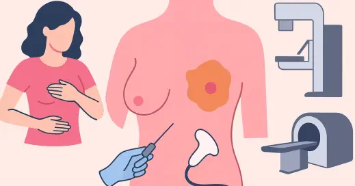 تفاوت لامپکتومی و مستکتومی در درمان سرطان پستان؛ کدام روش مناسب‌تر است؟