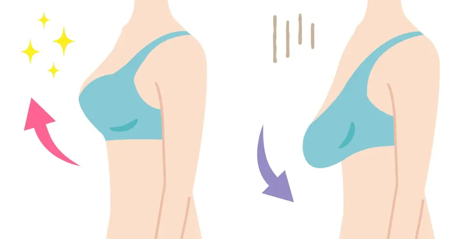 لیفت سینه (ماستوپکسی)؛ این جراحی برای چه کسانی مناسب است؟